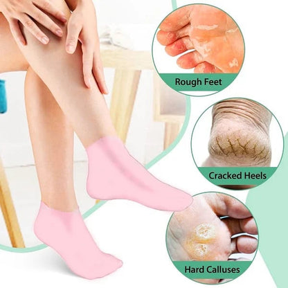 🧴 Pair with Your Lotion for Deep Moisture!🔥Women's Foot Care Silicone Socks